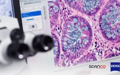 Innovación al Microscopio: La Revolución en el Diagnóstico de Enfermedades Crónicas y sus Implicaciones para el Sector Empresarial