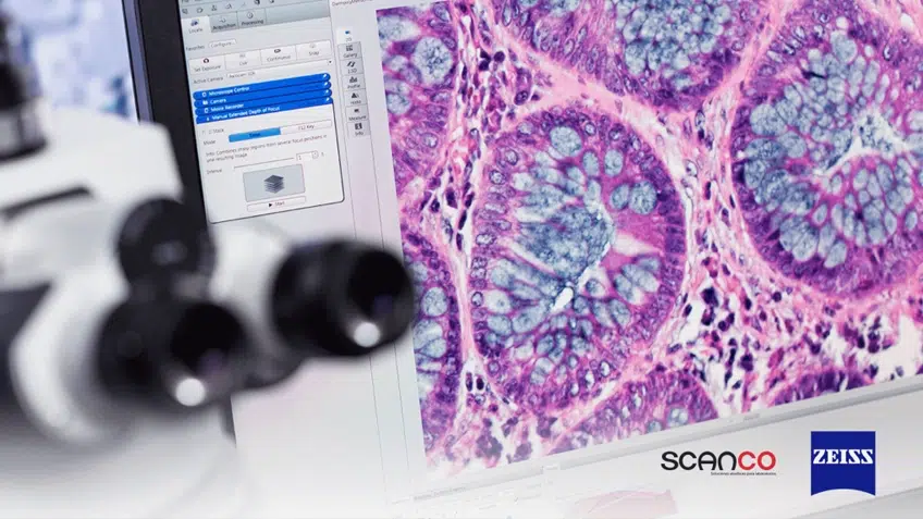Innovación al Microscopio: La Revolución en el Diagnóstico de Enfermedades Crónicas y sus Implicaciones para el Sector Empresarial